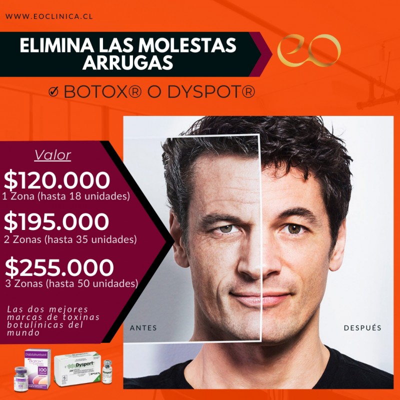 Eoclinica - Somos especialistas en Toxina BotulÃ­nica (Botox y Dysport).Â Elimina las lÃ­neas de expresiÃ³n y obtÃ©n un aspecto mÃ¡s joven