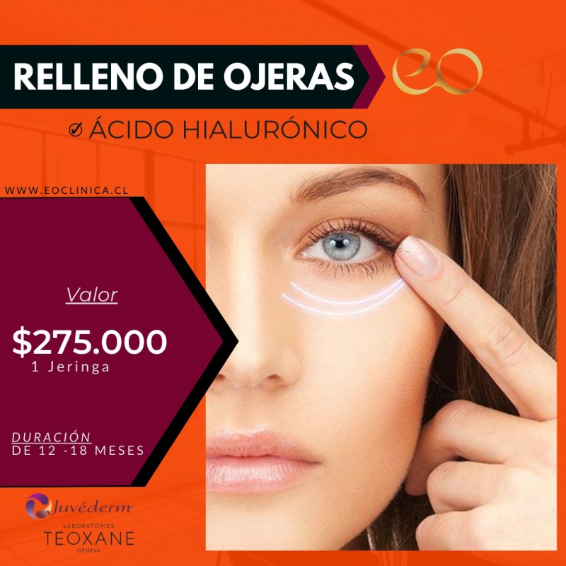 Eoclinica - Elimina el cansancio de tus ojeras con ÃcidoÂ HialurÃ³nico Volbella de Juvederm